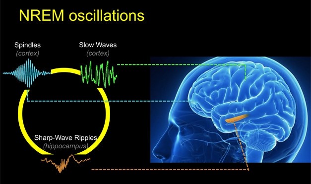 Sleep spindles image brain and brain waves graph. 