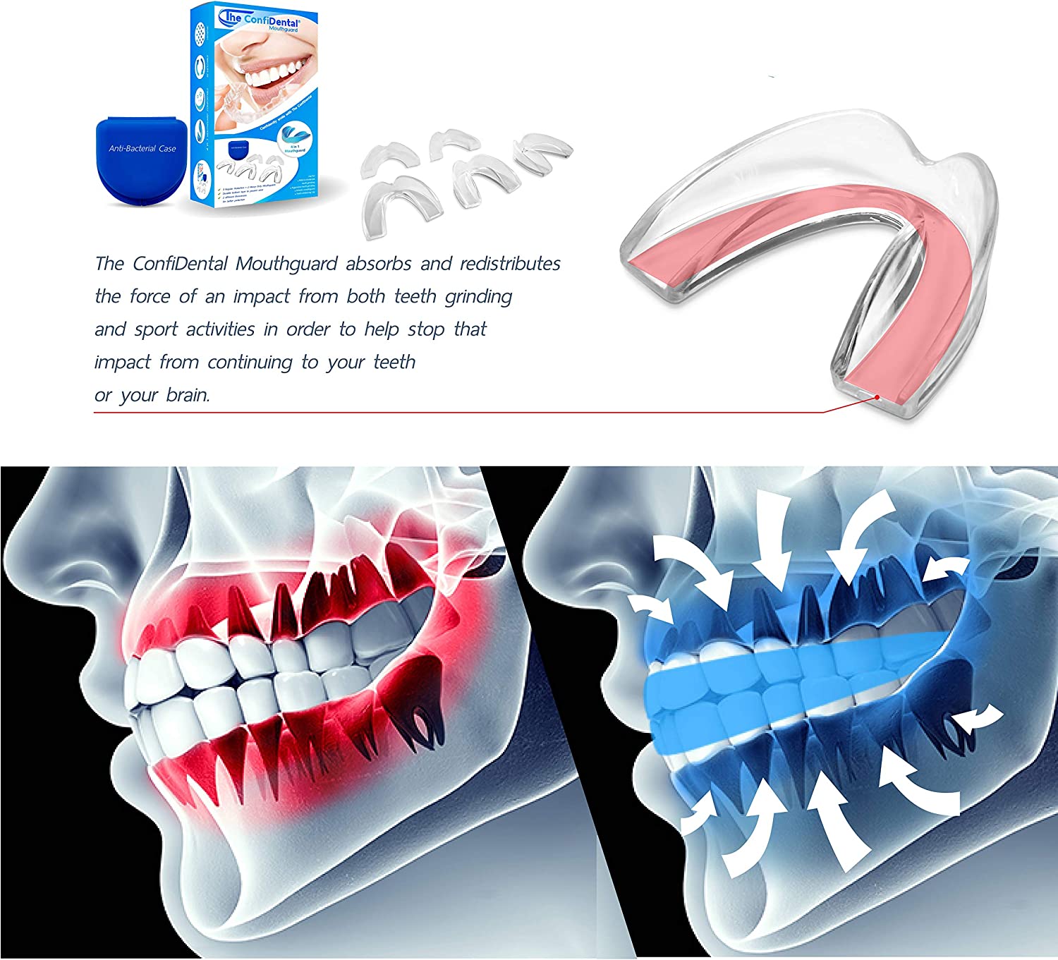 Teeth grinding is a symptom that may prompt you to ask yourself "what sleep disorder do I have?"